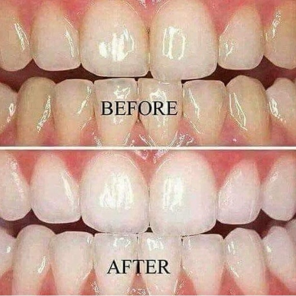 Whitening Toothpaste - Picture 10 of 16